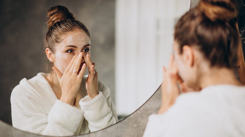 Thoa kem trị mụn đúng cách