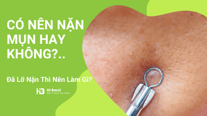 Nặn Mụn Đúng Cách