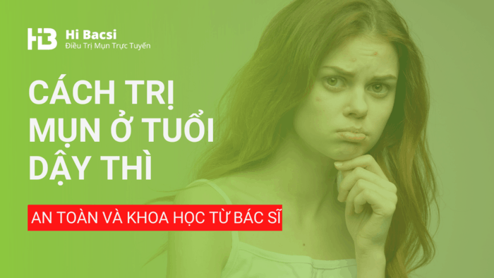 Cách trị mụn ở tuổi dậy thì