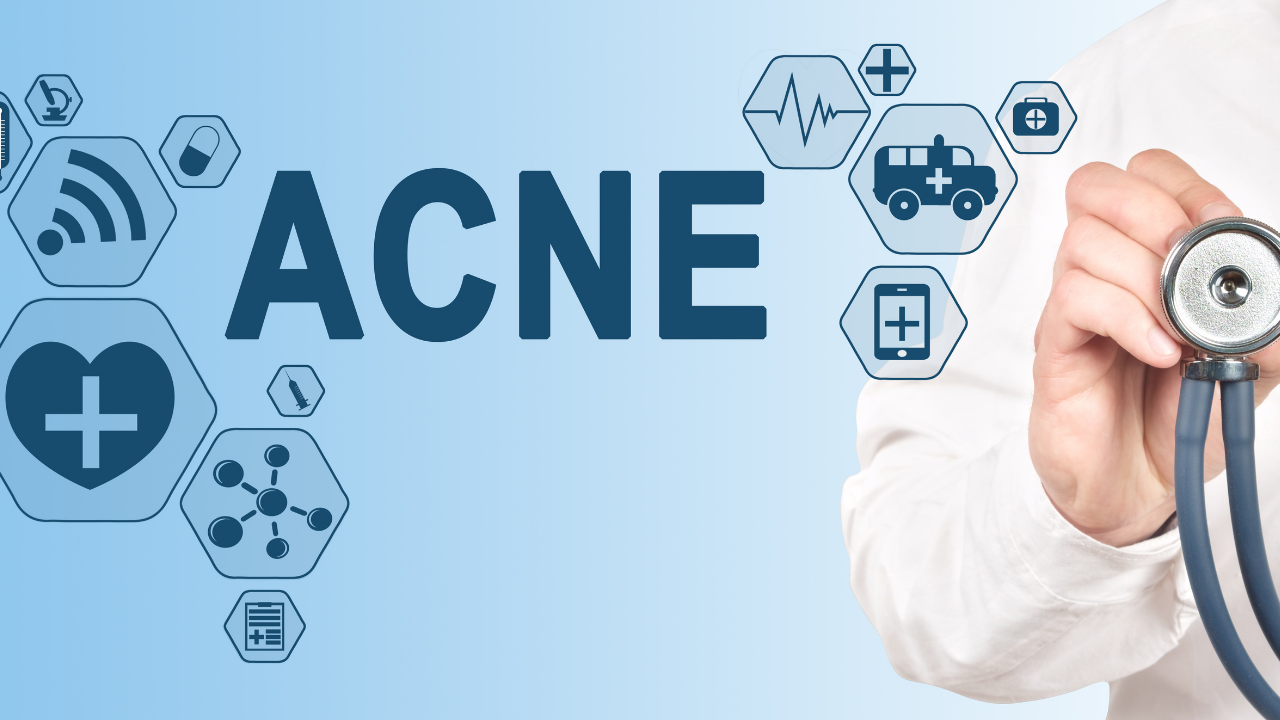 Điều trị mụn đầu trắng, mụn đầu đen