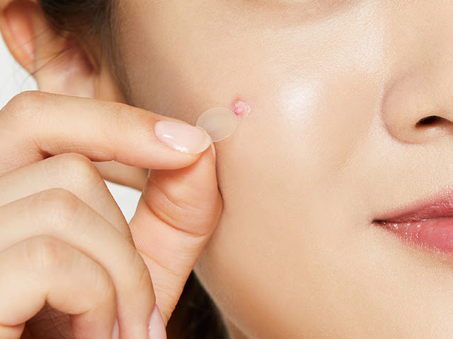 Miếng dán mụn che khuyết điểm